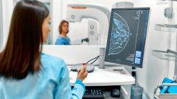 Greece has most mammography units in EU