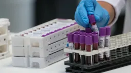 50-year mystery solved: New blood group 'MAL' discovered