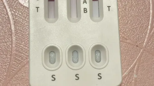 Flu and RSV cases rise in Greece, health officials urge vaccination