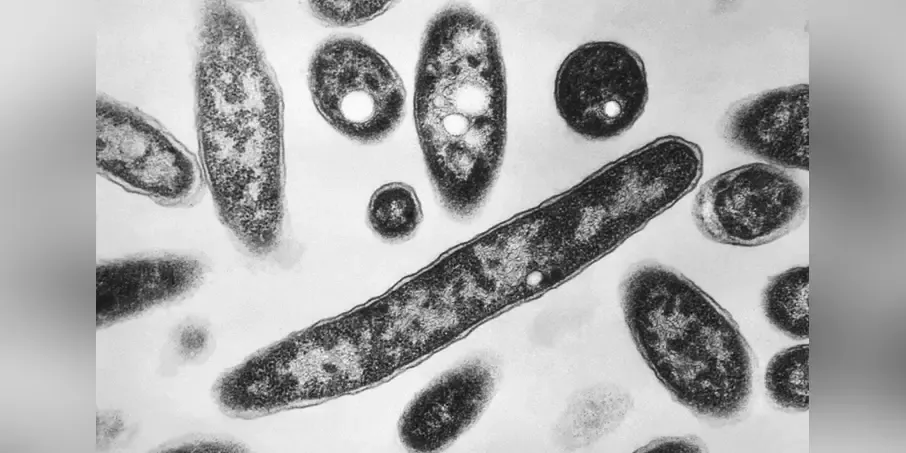 Greece records 180 Legionnaires’ disease cases as majority involve tourists