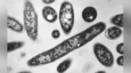 Greece records 180 Legionnaires’ disease cases as majority involve tourists