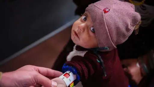3.7 million Afghan children face acute malnutrition crisis