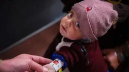 3.7 million Afghan children face acute malnutrition crisis