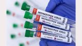 48 Monkeypox cases in Greece
