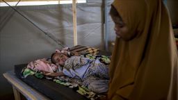 Following years of decline, cholera cases are rising worldwide, says WHO